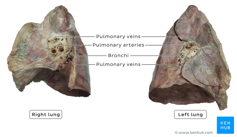 Medial view of cadaveric lungs