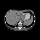 Verdauungssystem und Bauchorgane (CT)