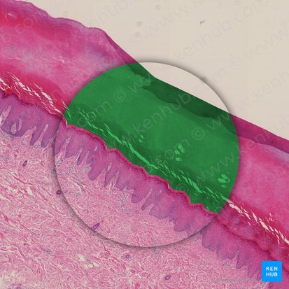 Stratum corneum of epidermis (Stratum corneum epidermis); Image: 