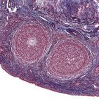 Histologie: Weibliches Fortpflanzungssystem