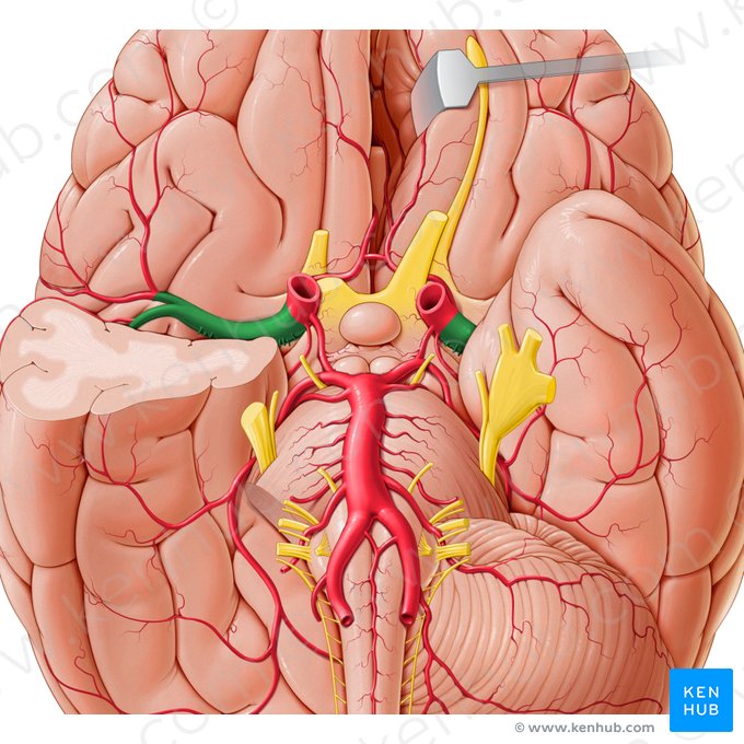 Artéria cerebral média (Arteria media cerebri); Imagem: Paul Kim