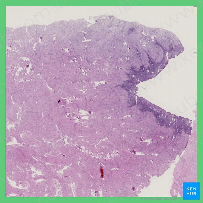 Phase folliculaire précoce (Phasis proliferativa incipiens (Uterus)); Image : 