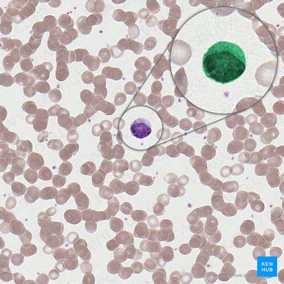 Linfócito grande (Lymphocytus magnus); Imagem: 