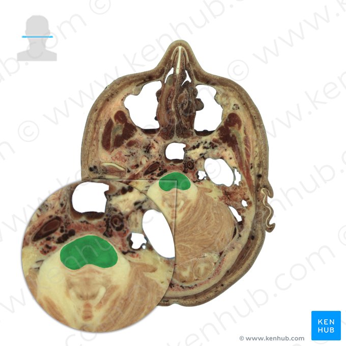 Pons; Image: National Library of Medicine