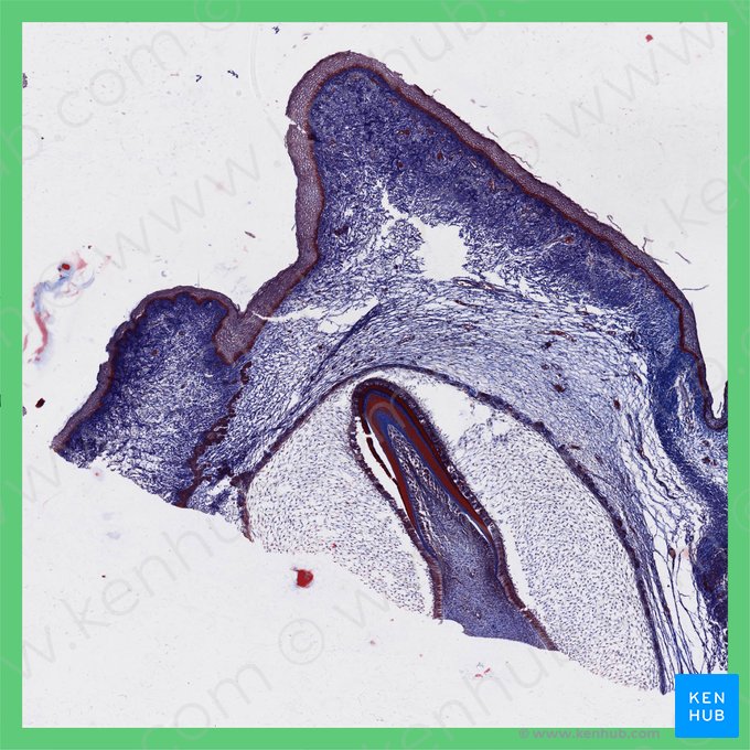 Fetal tooth; Image: 