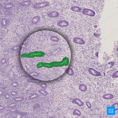 Long, curved endometrial glands; Image: 