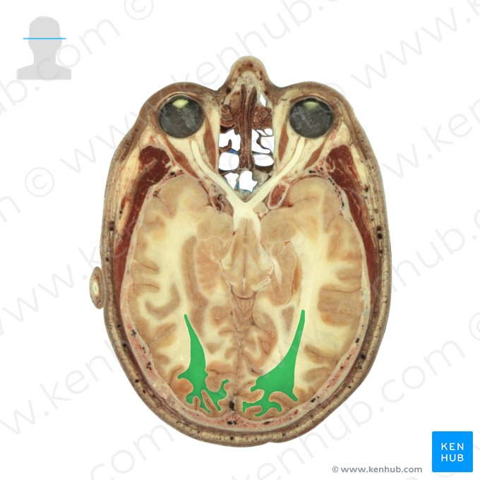 Radiação óptica (Radiatio optica); Imagem: National Library of Medicine