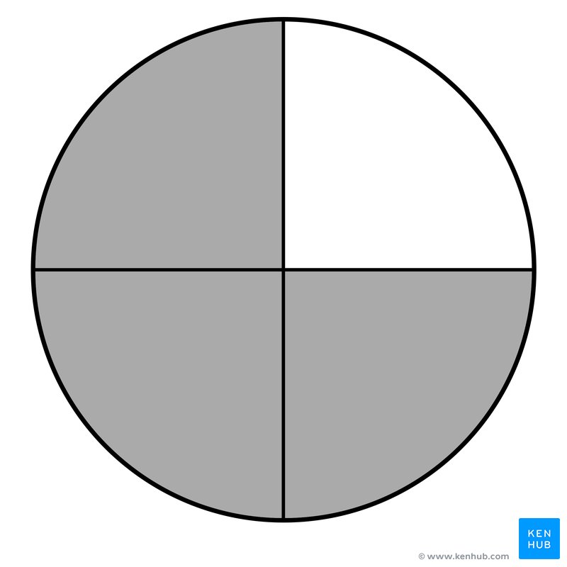 Visual field examination - Visual perception only in superonasal quadrant