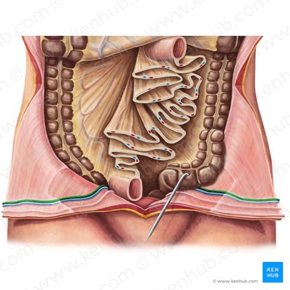 Arteria epigastrica inferior (Untere Bauchdeckenarterie); Bild: Irina Münstermann