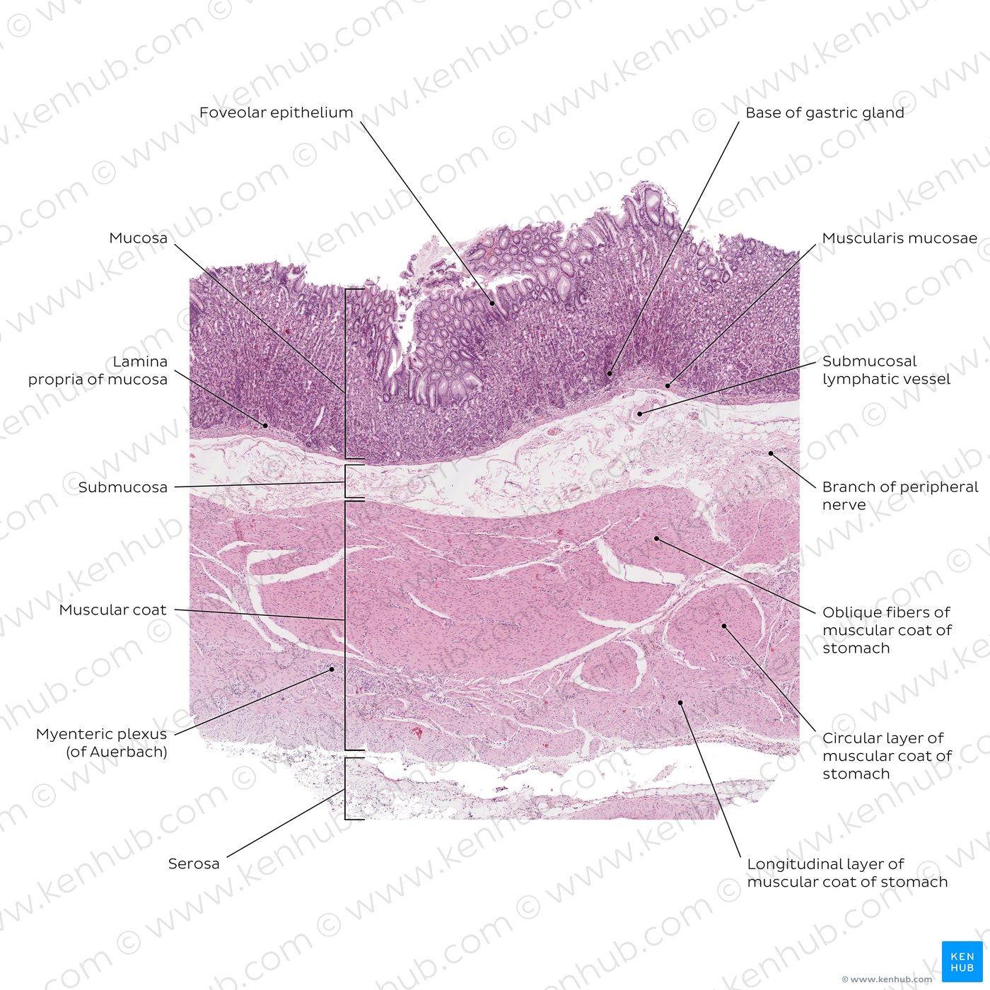 Stomach wall. Stain: H&E. Low magnification.