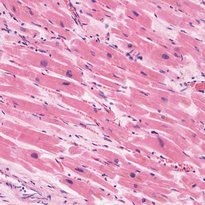 Muscle tissue