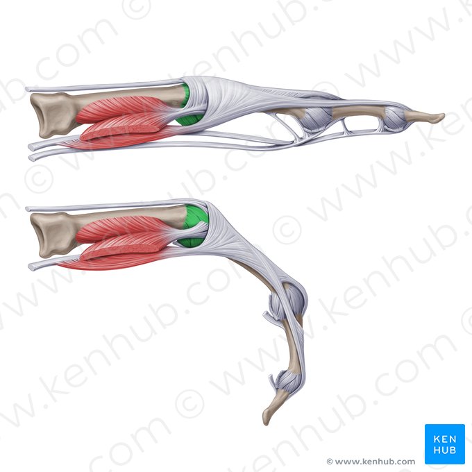 Ligamentos metacarpofalângicos colaterais (Ligamenta metacarpophalangea collateralia); Imagem: Paul Kim