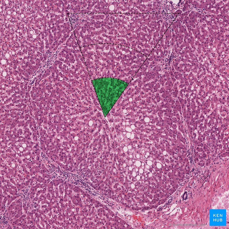 Zone 3 - histological slide