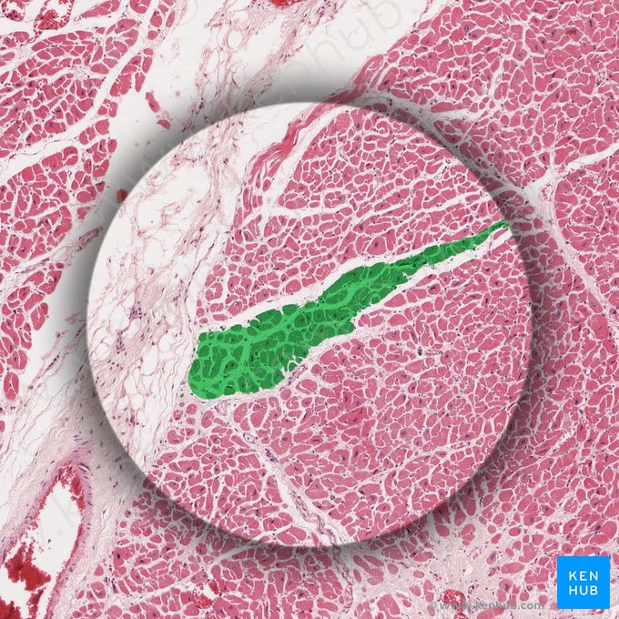 Cardiac muscle fascicle (Fasciculus muscularis cardiacus); Image: 