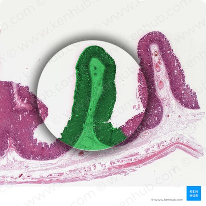 Pliegues gástricos (Plicae gastricae); Imagen: 