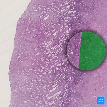 Myometrium (Muskelschicht der Gebärmutter); Bild: 