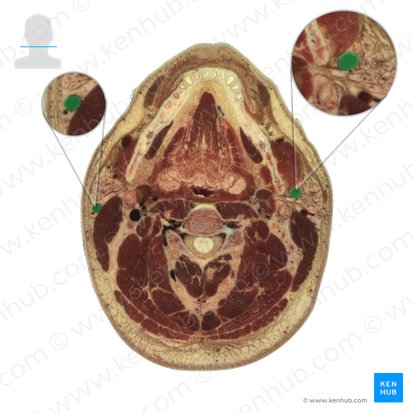 Vena jugularis externa (Äußere Drosselvene); Bild: National Library of Medicine