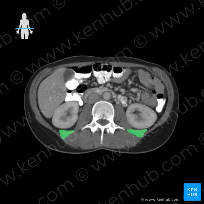 Musculus quadratus lumborum (Viereckiger Lendenmuskel); Bild: 