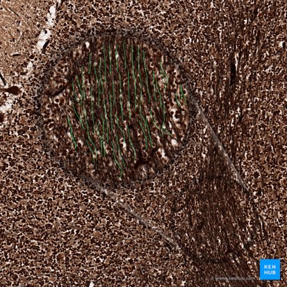 Mossy fibers; Image: 