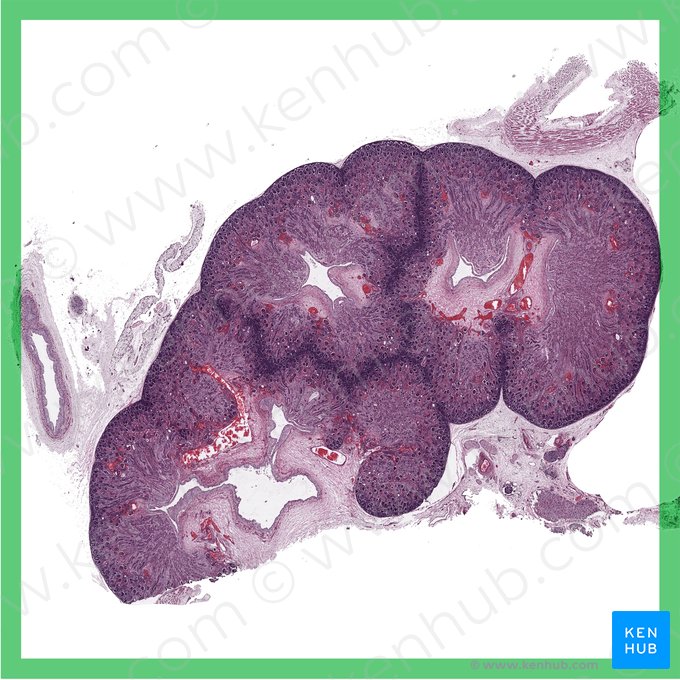 Riñón fetal (Ren fetalis); Imagen: 