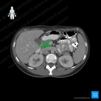 Pancreas; Image: 