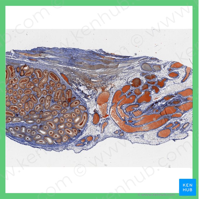 Epididymis (Nebenhoden); Bild: 