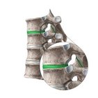 Intervertebral joints