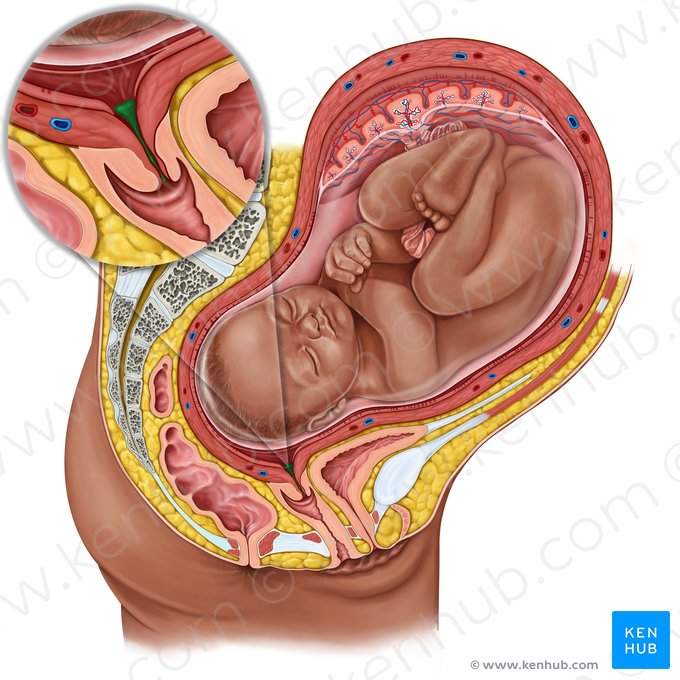 Obturamentum cervicale (Schleimpfropf); Bild: Irina Münstermann