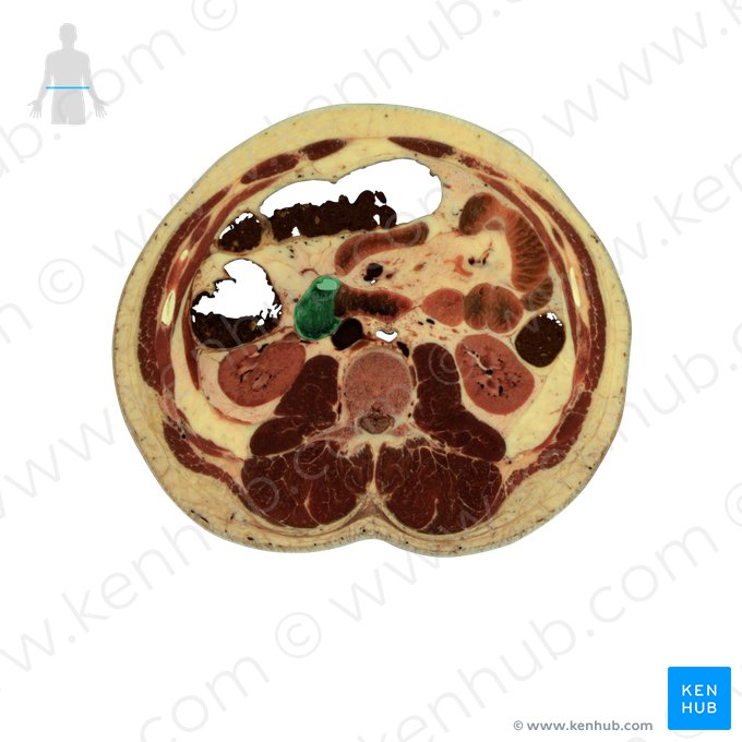 Descending part of duodenum (Pars descendens duodeni); Image: National Library of Medicine