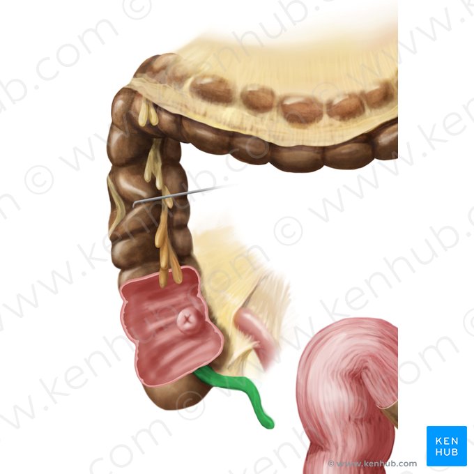 Appendix vermiformis (Wurmfortsatz); Bild: Begoña Rodriguez