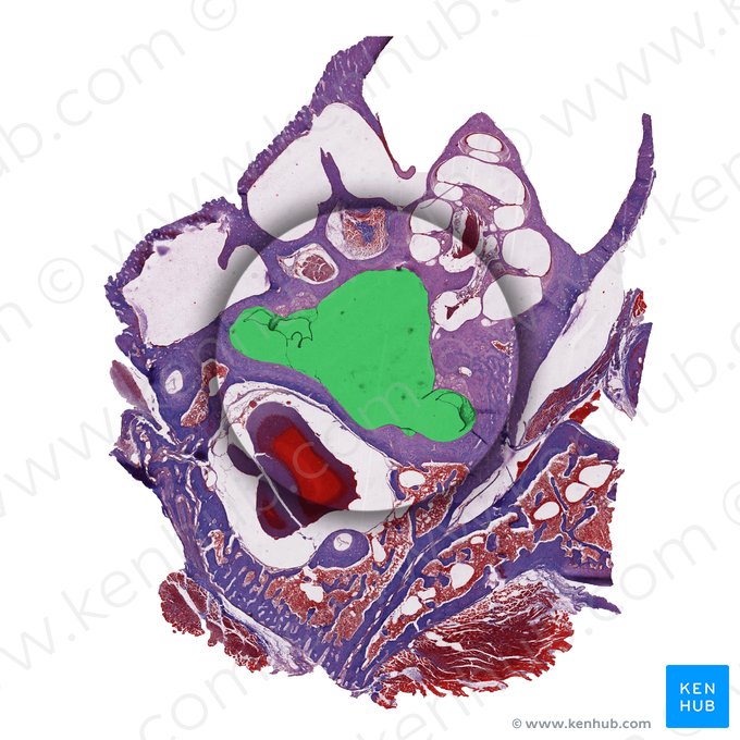 Vestibulum auris internae (Vorhof des Innenohrs); Bild: 