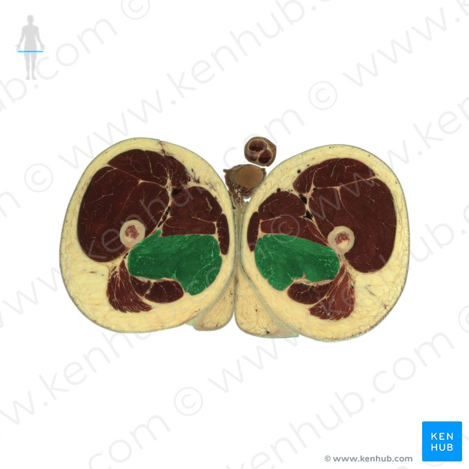 Musculus adductor magnus (Großer Oberschenkelanzieher); Bild: National Library of Medicine