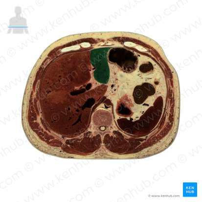 Lobus sinister hepatis (Linker Leberlappen); Bild: National Library of Medicine