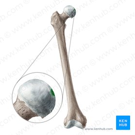 Fovea for ligament of head of femur (Fovea capitis ossis femoris); Image: Liene Znotina