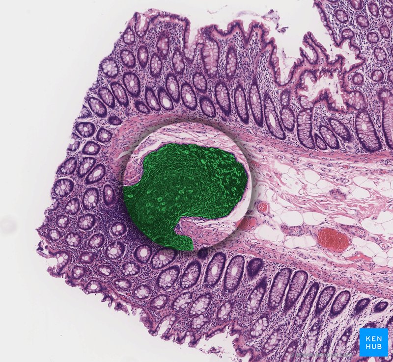 Mucosa associated lymphoid tissue of colon - histological slide