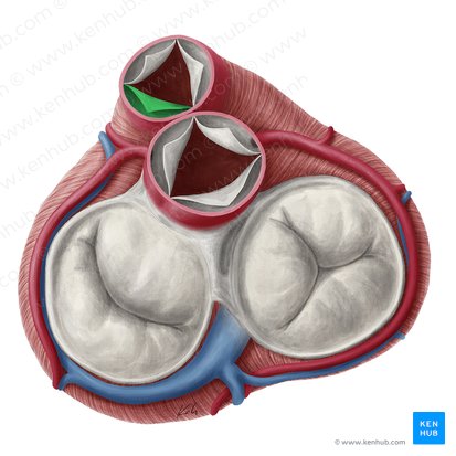 Left semilunar leaflet of pulmonary valve (Valvula semilunaris sinistra valvae trunci pulmonalis); Image: Yousun Koh