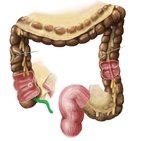 Apêndice vermiforme e o ceco (cego)