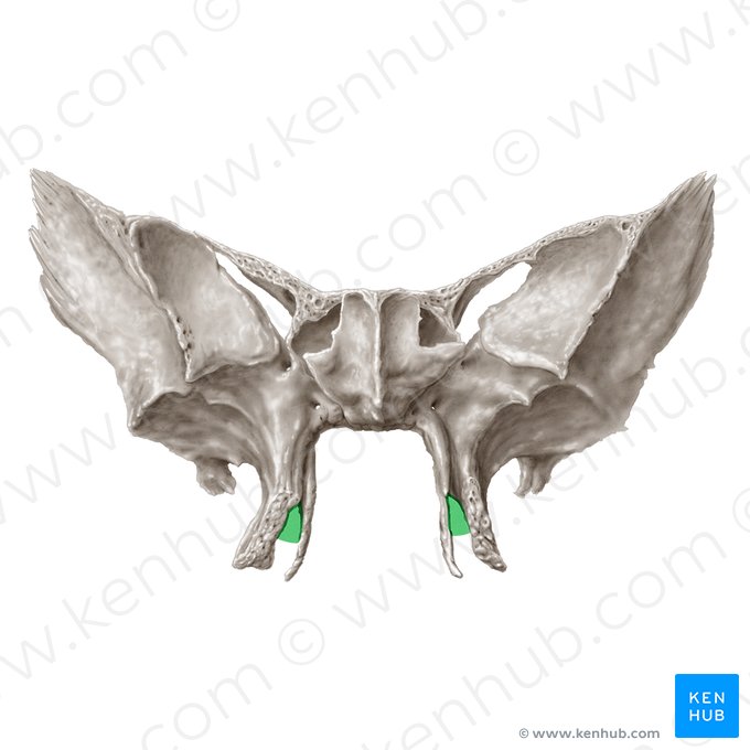 Incisura pterygoidea ossis sphenoidalis (Flügeleinschnitt des Keilbeins); Bild: Samantha Zimmerman