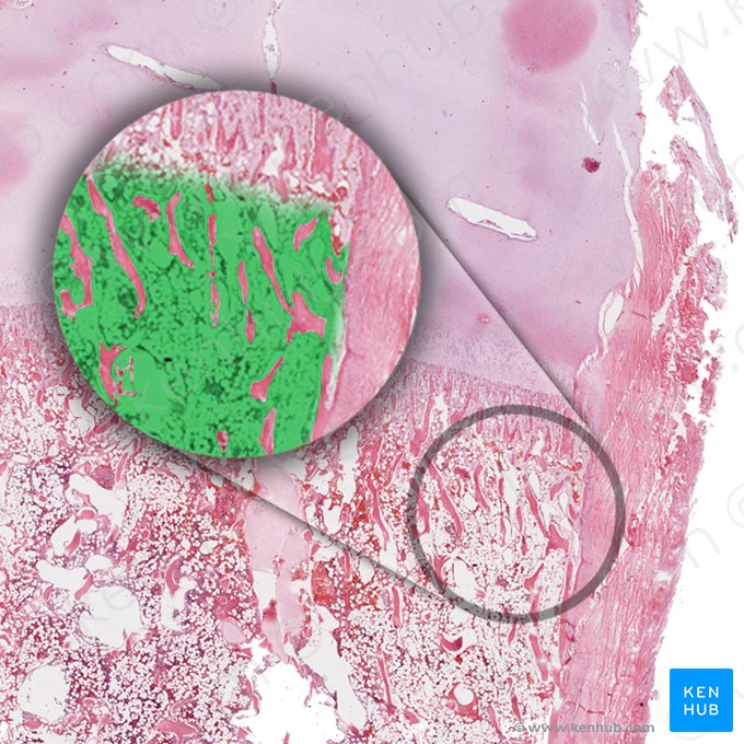 Bone marrow (Medulla ossium); Image: 