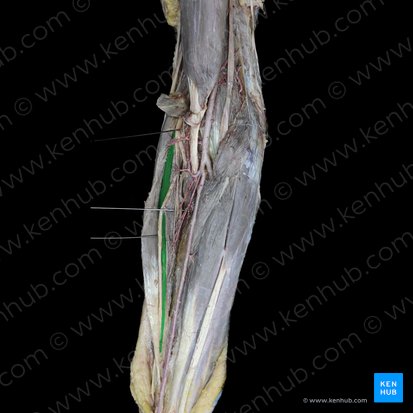 Musculus extensor carpi radialis longus (Langer speichenseitiger Handstrecker); Bild: 