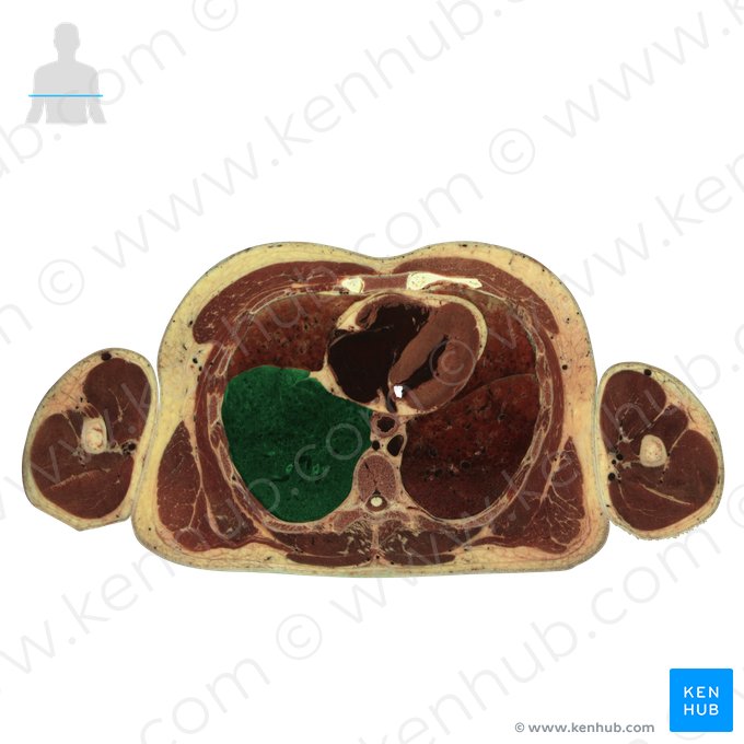 Lobo inferior do pulmão direito (Lobus inferior pulmonis dextri); Imagem: National Library of Medicine