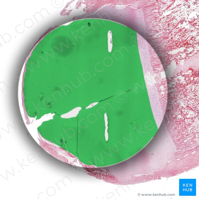 Transitionalzone; Bild: 