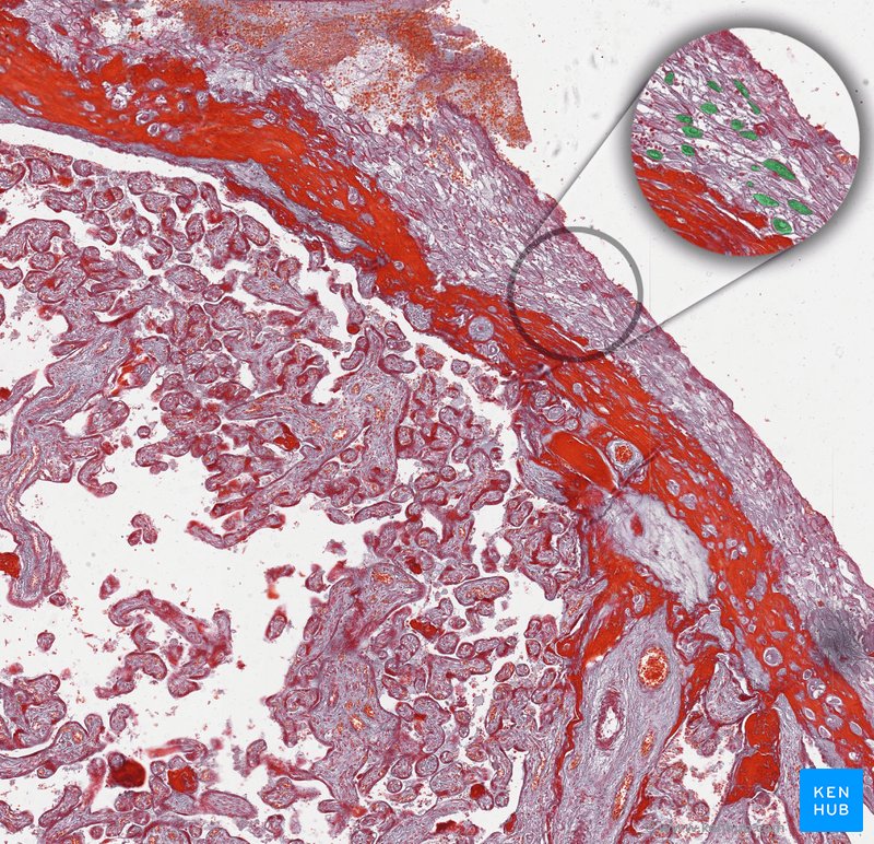 Decidual cells - histological slide