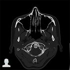 Medical imaging at the level of C1