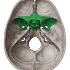 Sphenoid bone