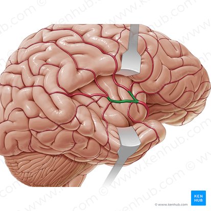 Partes corticales superiores et inferiores arteriae cerebri mediae (Obere und untere Endäste der mittleren Hirnarterie); Bild: Paul Kim