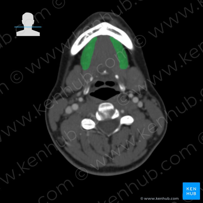 Muscle mylohyoïdien (Musculus mylohyoideus); Image : 