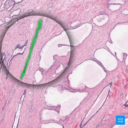 Coronal venous plexus (Plexus venosus coronalis); Image: 