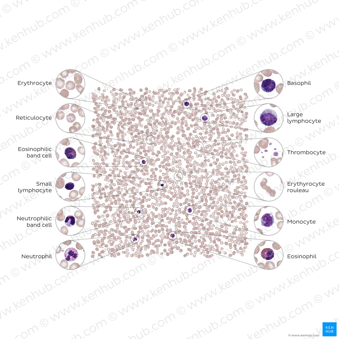 Blood smear