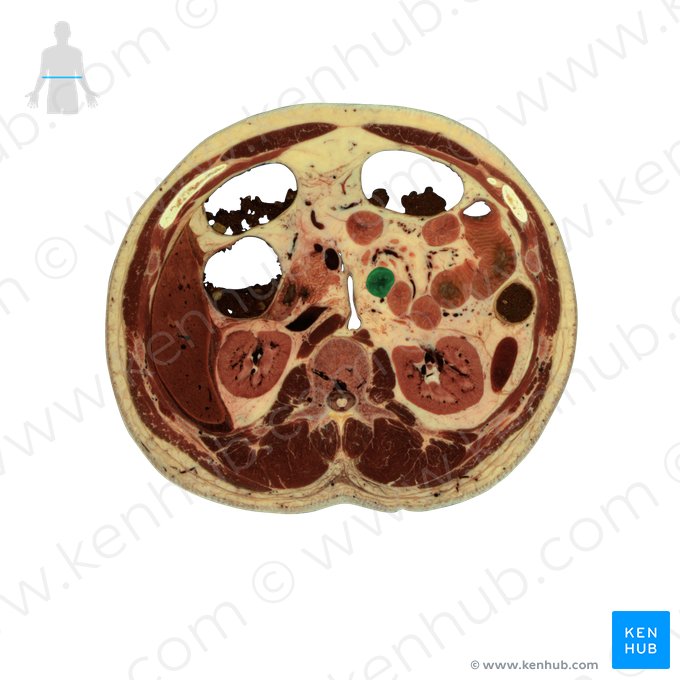 Ascending part of duodenum (Pars ascendens duodeni); Image: National Library of Medicine